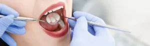 The Benefits of Routine Dental Examinations